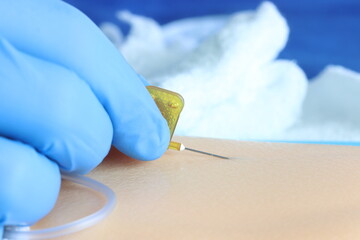 Close up of a healthcare professional inserting a butterfly catheter in a simulated skin 