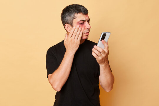 Sufferer man in black T-shirt with bruises and abrasions on his face isolated over beige background looking at mobile phoine camera at his injures after bandits attack.