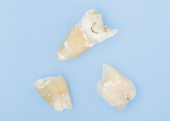 Fototapeta na wymiar Overhead view of an extracted molar tooth in three pieces
