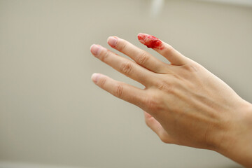 Female hand with red blood, little finger is bleeding profusely. Woman injured her little finger at...