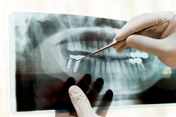 Dentist examining a panoramic dental x-ray