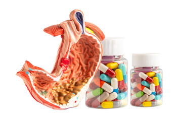 Gastritis medication drug for stomach ache, Gastroesophageal reflux disease GERD, medicine treatment.