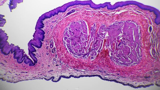 Human penis in cross section filmed under microscope 40x against bright field background. Organ of male reproductive system is educated in scientific laboratory to exam its structure on anatomy lesson