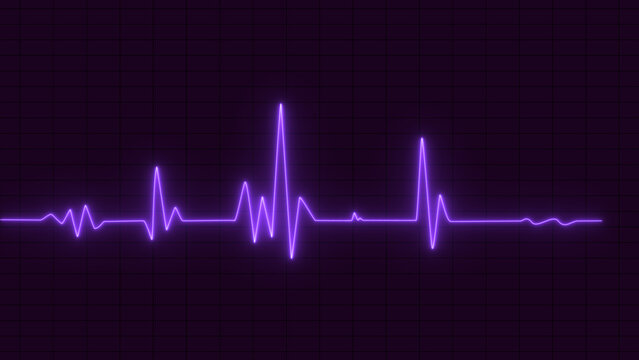 glowing neon heartbeat, pulse line. Heartbeat cardiogram graph background. Neon pulse line on hospital monitor. Health, medicine, graphic concept.
