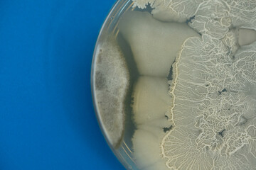 Top view agar plate for diagnosis bacterial or microorganism isolate on blue background at...