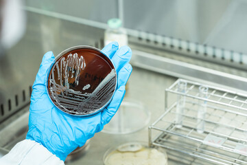Scientist hand wearing blue gloves hold agar plate for diagnosis bacterial or microorganism in the...