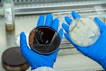 Scientist hand wearing blue gloves hold agar plate for diagnosis bacterial or microorganism in the...