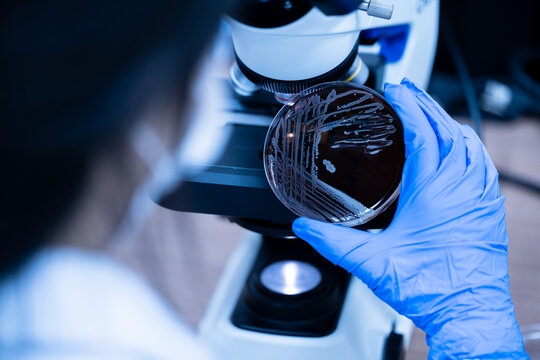 Scientist holding agar plate for diagnosis bacterial or  microorganism, blurry microscopy background at laboratory. Selective petri dish with colonies of bacteria under the lens of a microscope.