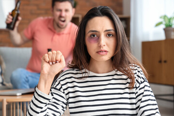 Bruised young woman gesturing at home, closeup. Domestic violence concept