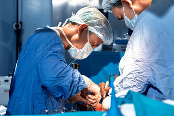 Portrait of surgeons leaned over patient during complex surgical operation in a sterile operating room. Doctors are focused and extremely attentive. Precision medicine, saving patient's life.