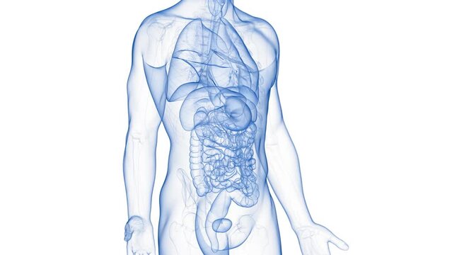 Animation of a neoplasm in the small intestine