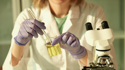 Laboratory researcher holds medical glass bottle with yellow liquid. Scientist examining urinalysis