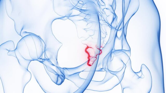 Animation of a man's inflamed tailbone