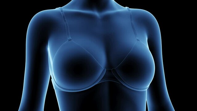 Animation of a woman after breast enhancement 