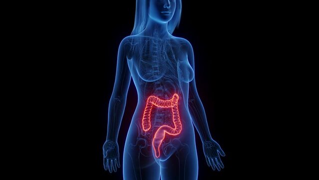 Animation of a woman's colon and rectum