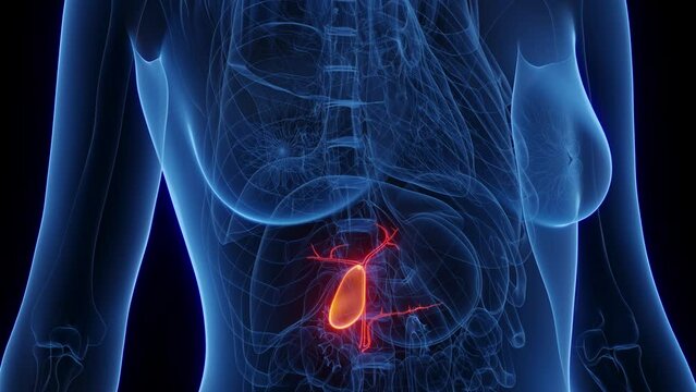 Animation of a woman's gallbladder