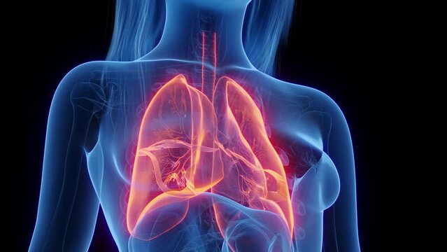 Animation of a woman's lower respiratory tract