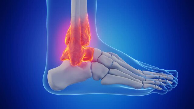 Animation of the bones of a man's right ankle