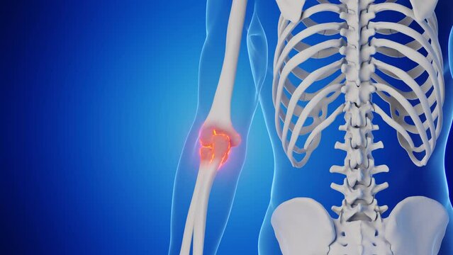 Animation of a man's right elbow joint