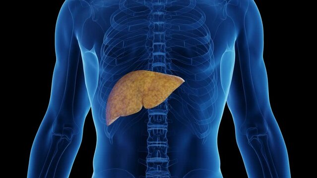 Animation of a man's fatty liver