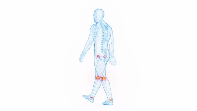 Animation of a man having joint pain while walking