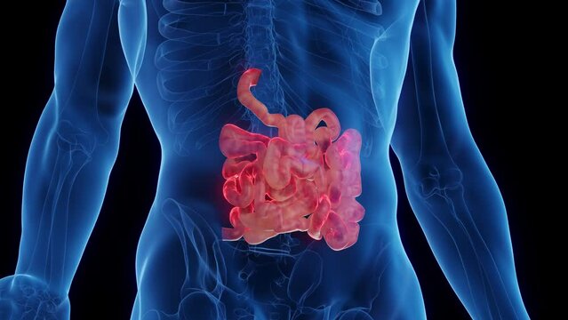 Animation of a man's inflamed small intestine