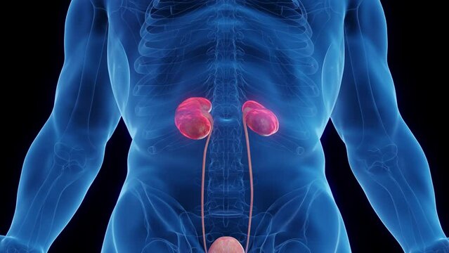 Animation of a man's inflamed kidneys