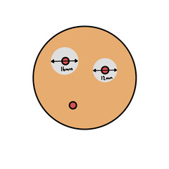 47 Calculating Inhibition Zone