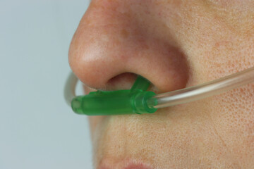 Close up to a woman’s nose wearing oxygen catheter
