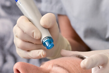 Hydrafacial skin treatment for anti-aging and rejuvenation of the skin, Close-up of cosmetic treatment on female patient