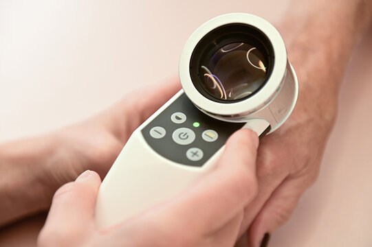 Female dermatologist examining hand with dermascope for skin diseases and melanoma
