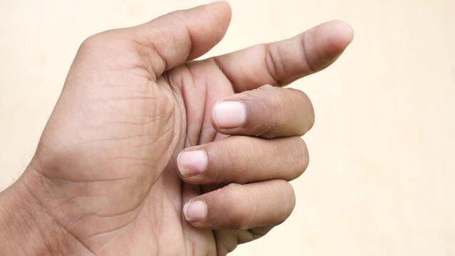  Fungal infection on nail ,  nail psoriasis