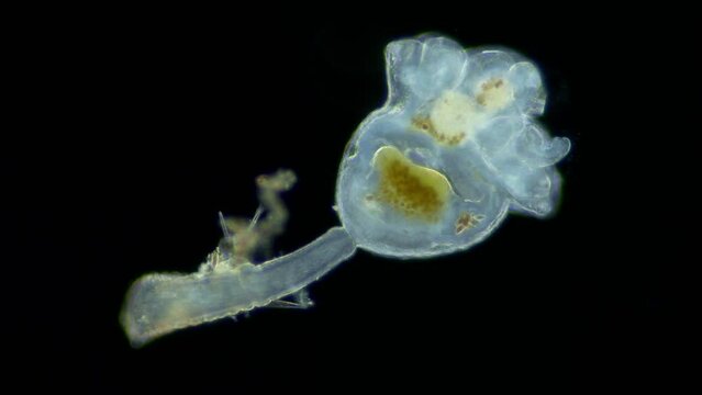 Entoprocta (Kamptozoa) family Pedicellinidae under a microscope, living in sea either singly or in colonies, were formerly considered a subclass of bryozoans. White Sea