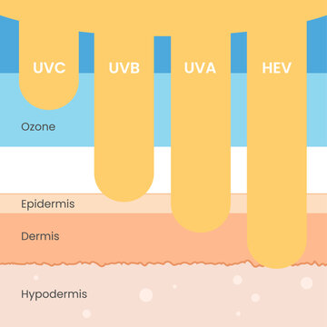 UV UVA UVB HEV skin protection. Sun radiation ultraviolet harmful rays stcok image vector. Sunburn skin layers, epidermis, dermis, hypodermis. Sunlight damage cancer risk. UV index chart, SPF cream