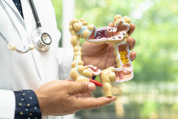 Intestine, appendix and digestive system, doctor holding anatomy model for study diagnosis and...