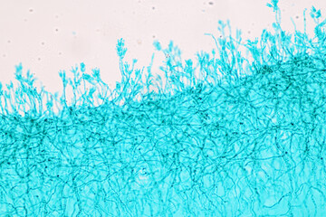 Tempeh is a soy-based food or mixed with other grains like rice, wheat, or barley.