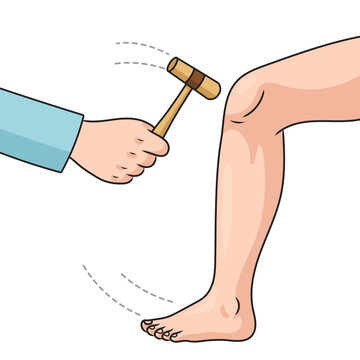 The doctor checks patellar reflex with a hammer diagram schematic vector illustration. Medical science educational illustration