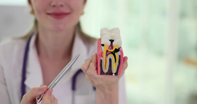 Dentist shows artificial model of teeth in clinic office. Doctor shows immediate development of caries from neglecting care of teeth slow motion