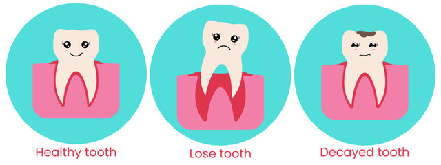 A set of different dental conditions. Vector illustration