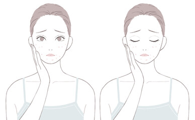 マスクニキビに悩む女性