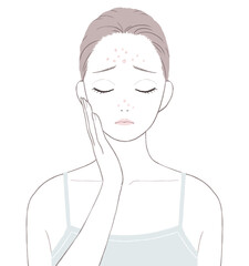 Tゾーンのニキビに悩む女性