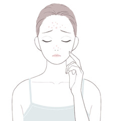 Tゾーンのニキビに悩む女性
