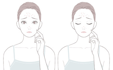 Tゾーンのニキビに悩む女性
