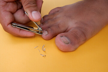 cut nails on toes isolated on yellow background. the concept of foot hygiene, dirty feet, and ugly