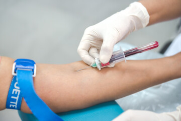 Medical  a blood sample from a patient in the hospital.