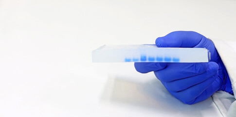 Scientist's hand showing an Agarose gel with DNA or protein samples, used in a laboratory of...