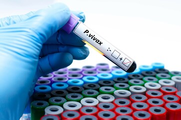 Blood sample of malaria patient positive test for plasmodium vivax.