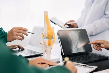 serious doctors team are analyzing fracture knee model showing the process of osteoarthritis...