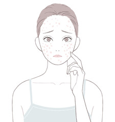 赤いニキビ跡に悩む女性