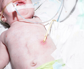 Pediatric intensive care. Perinatal Medicine. Infant resuscitation. 